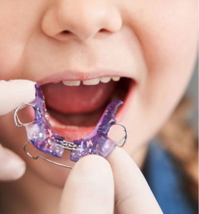 Niña con brackets